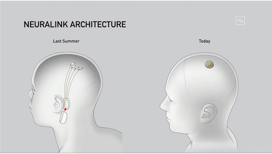 未来医疗的希望：马斯克确认2025年Neuralink将为患者植入脑机设备计划_马斯克宣布芯片植入人脑_马斯克脑植入芯片的价格